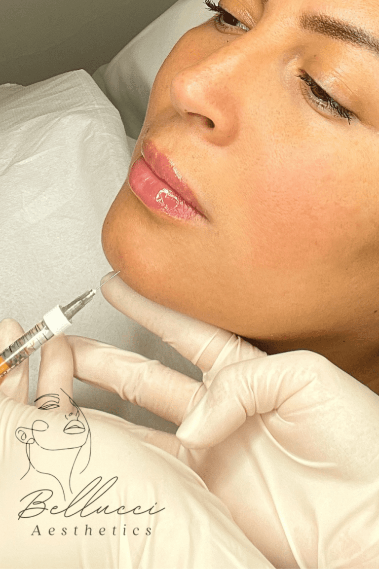 chin dermal fillers - bellucci aesthetics 2