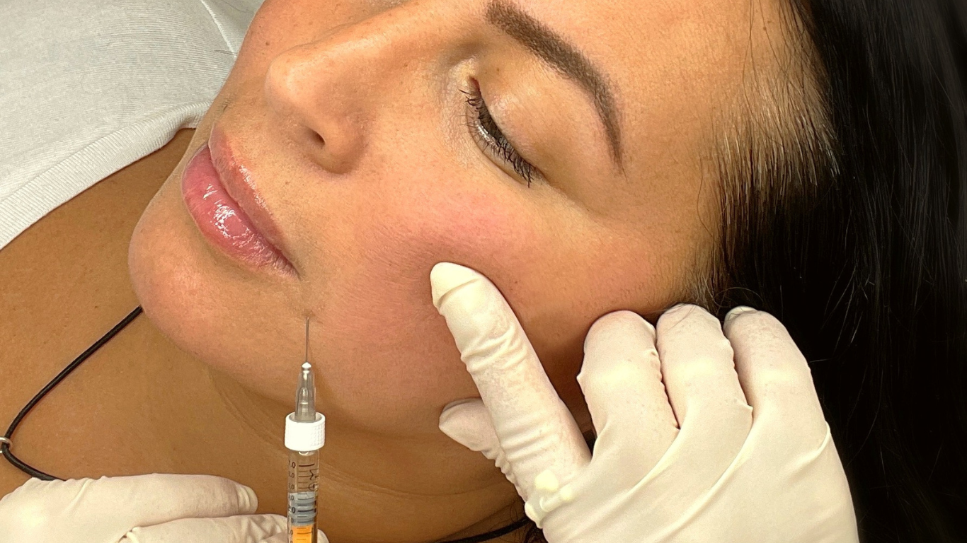 line Fillers Bellucci Aesthetics