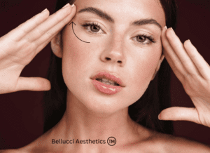 Can Temple Fillers lift the face? bellucci aesthetics london aesthetics