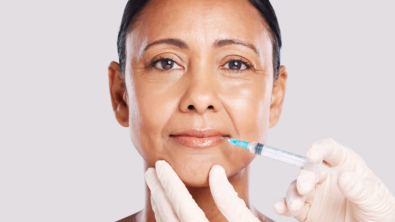 Lip Filler Techniques for Mature Patients - bellucci aesthetics