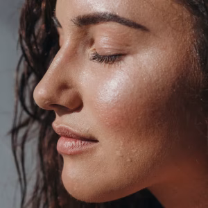 Deposit – Aesthetic Treatment (£100)